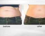 Tummy Lifts